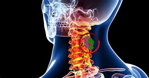cancer of the spine symptoms.